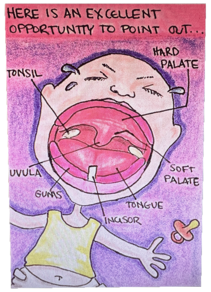 Colored picture drawing of baby crying with mouth anatomy indicated.